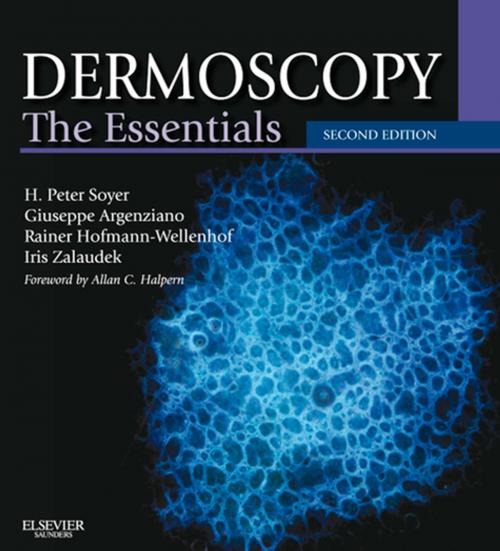 Cover of the book Dermoscopy E-Book by H. Peter Soyer, MD, FACD, Giuseppe Argenziano, MD, Rainer Hofmann-Wellenhof, MD, Iris Zalaudek, MD, Elsevier Health Sciences