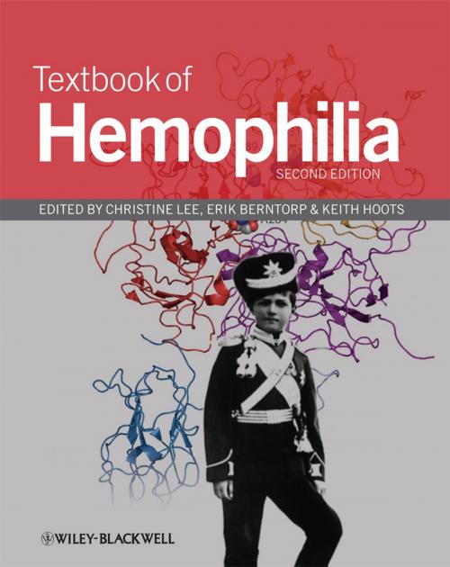 Cover of the book Textbook of Hemophilia by , Wiley