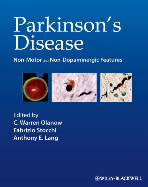 Cover of the book Parkinson's Disease by , Wiley