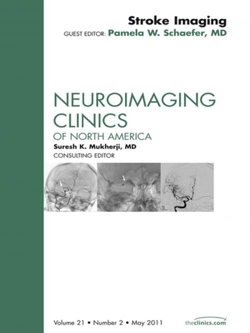 Cover of the book Imaging of Ischemic Stroke, An Issue of Neuroimaging Clinics - E-Book by Alisa Gean, MD, Elsevier Health Sciences