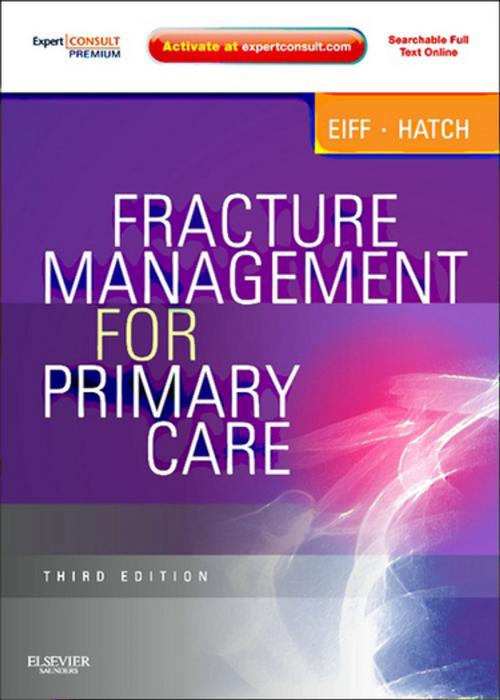Cover of the book Fracture Management for Primary Care E-Book by M. Patrice Eiff, MD, Robert L. Hatch, MD, MPH, Elsevier Health Sciences