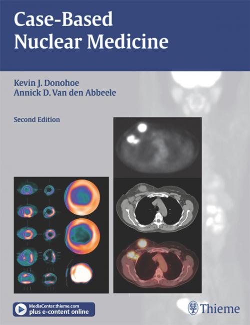 Cover of the book Case-Based Nuclear Medicine by , Thieme
