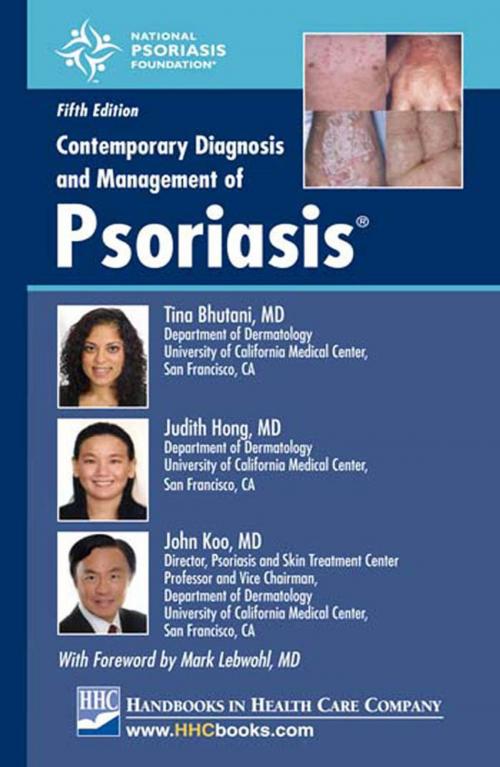 Cover of the book Contemporary Diagnosis and Management of Psoriasis®, 5th edition by John Koo, MD, Judith Hong, MD, Tina Bhutani, MD, Handbooks in Health Care Co.