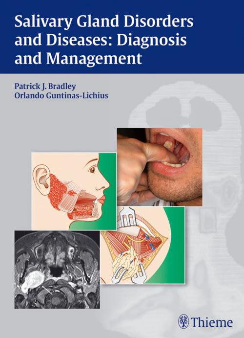 Cover of the book Salivary Gland Disorders and Diseases: Diagnosis and Management by , Thieme