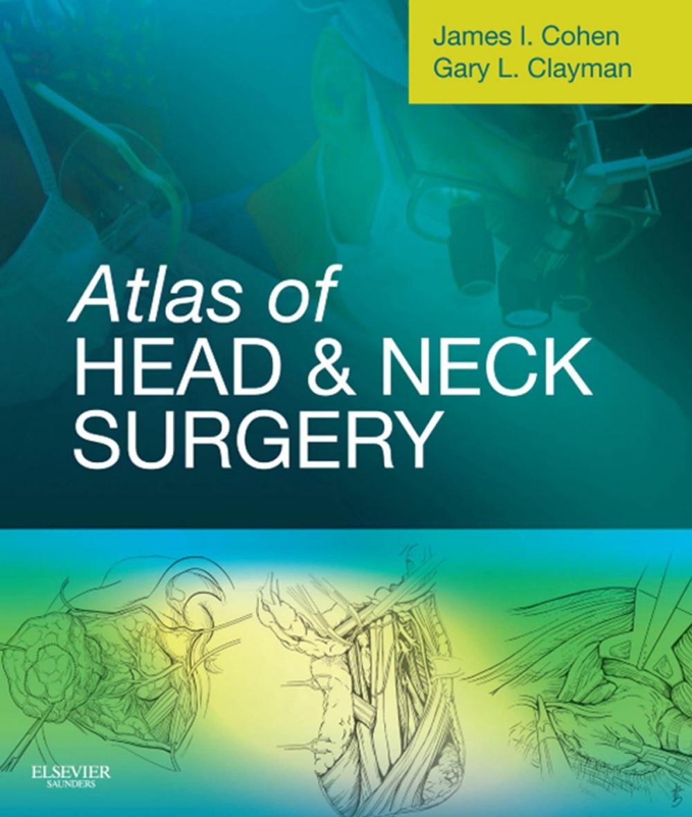 Big bigCover of Atlas of Head and Neck Surgery E-Book