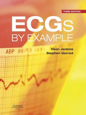 Cover of the book ECGs by Example E-Book by Jeffrey Swigris, Aryeh Fischer, Kevin K Brown, MD