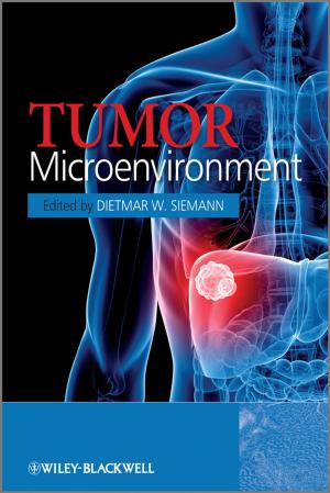 Cover of the book Tumor Microenvironment by K. Linga Murty, Indrajit Charit