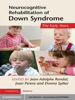 Cover of the book Neurocognitive Rehabilitation of Down Syndrome by Eve V. Clark