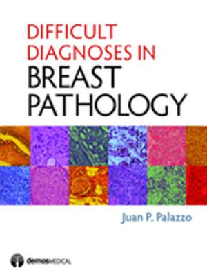 Cover of the book Difficult Diagnoses in Breast Pathology by Sean Lauderdale, PhD, Kristen H. Sorocco, PhD