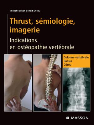 Cover of the book Thrust, sémiologie, imagerie by 