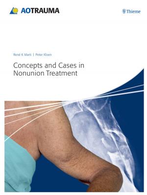Cover of the book Concepts and Cases in Nonunion Treatment by Anne M Gilroy, Brian R MacPherson, Michael Schuenke
