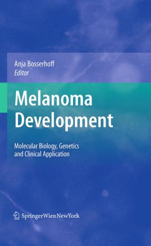 Cover of the book Melanoma Development by L. Symon, B. Guidetti, E. Pásztor, F. Loew, B. Pertuiset, J. D. Miller, J. Brihaye, M. G. Ya?argil, H. Nornes