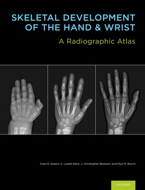 Cover of the book Skeletal Development of the Hand and Wrist by MD MBA S. Lowell Kahn, Cree M. Gaskin, J. Christoper Bertozzi, Paul M. Bunch, Oxford University Press