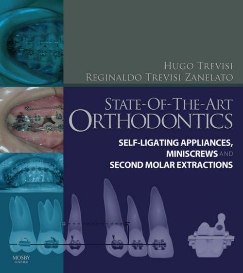 Cover of the book State-of-the-Art Orthodontics E-Book by Reginaldo C. Trevisi Zanelato, Hugo Trevisi, DDS, Elsevier Health Sciences