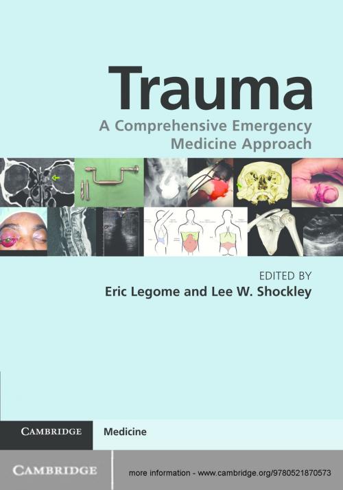 Cover of the book Trauma by , Cambridge University Press