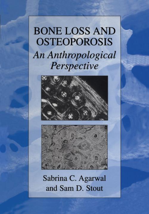Cover of the book Bone Loss and Osteoporosis by , Springer US