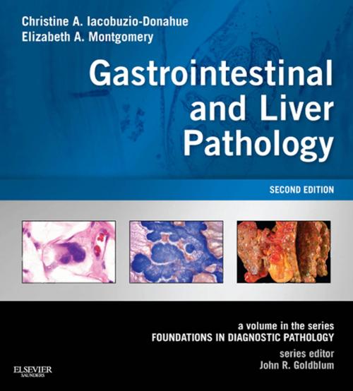 Cover of the book Gastrointestinal and Liver Pathology E-Book by John R. Goldblum, MD, FCAP, FASCP, FACG, Christine A. Iacobuzio-Donahue, MD, PhD, Elizabeth A Montgomery, MD, Elsevier Health Sciences