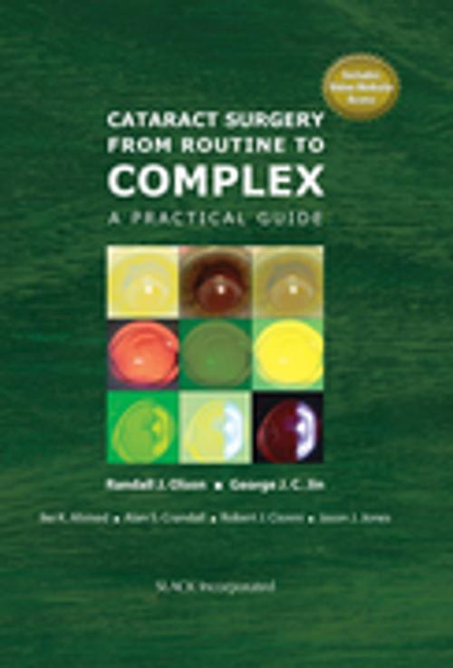Cover of the book Cataract Surgery from Routine to Complex by , SLACK Incorporated