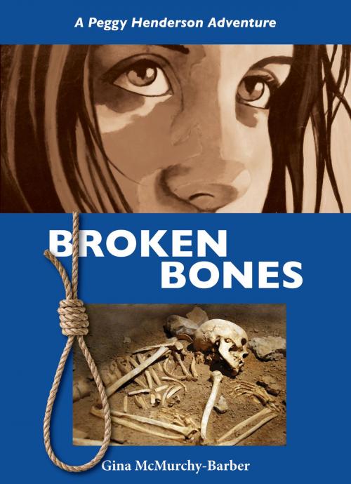 Cover of the book Broken Bones by Gina McMurchy-Barber, Dundurn