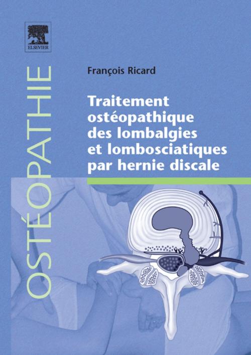 Cover of the book Traitement ostéopathique des lombalgies et lombosciatiques par hernie discale by François Ricard, Elsevier Health Sciences