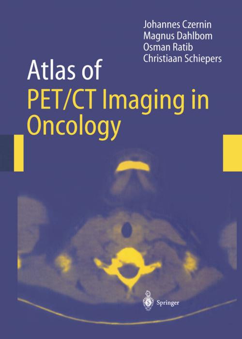 Cover of the book Atlas of PET/CT Imaging in Oncology by Johannes Czernin, Magnus Dahlbom, O. Ratib, Christiaan Schiepers, Springer Berlin Heidelberg