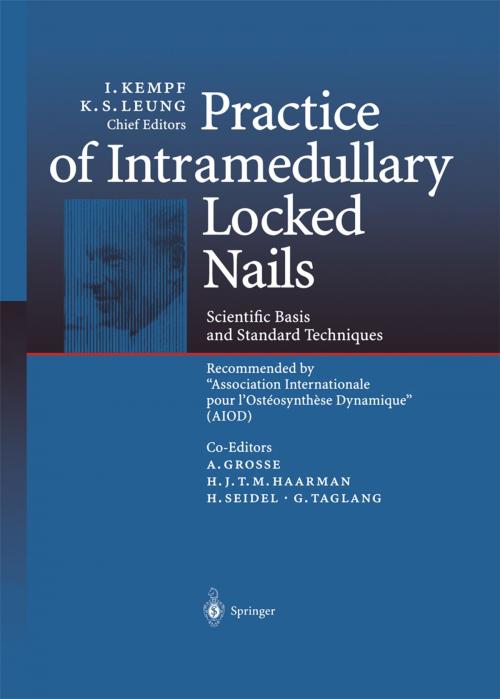 Cover of the book Practice of Intramedullary Locked Nails by A. Grosse, H.J.T.M. Haarman, H. Seidel, G. Taglang, Springer Berlin Heidelberg