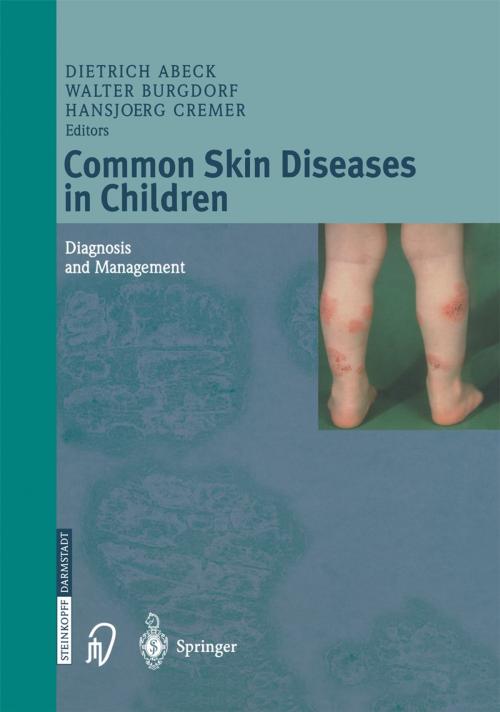 Cover of the book Common Skin Diseases in Children by , Steinkopff