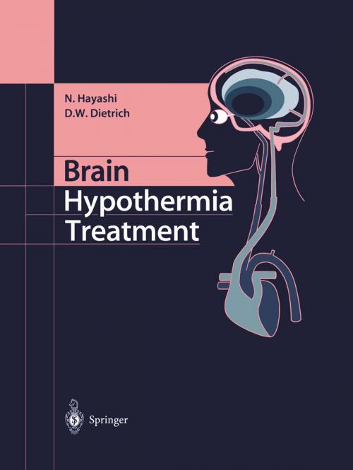 Cover of the book Brain Hypothermia Treatment by Nariyuki Hayashi, Dalton W. Dietrich, Springer Japan