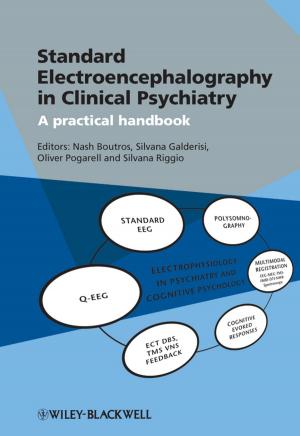 Cover of the book Standard Electroencephalography in Clinical Psychiatry by Terje Aven