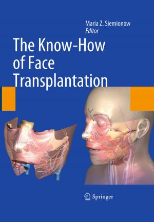 Cover of the book The Know-How of Face Transplantation by Heike Sefrin-Weis