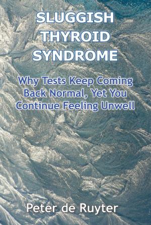 Cover of the book Sluggish Thyroid Syndrome by Kedar N. Prasad, Ph.D.