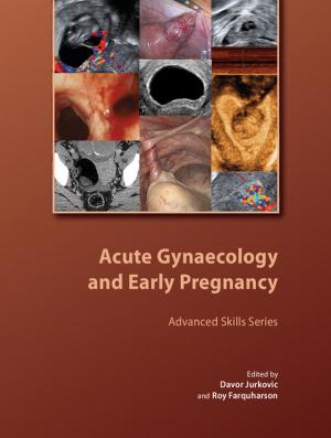 Cover of the book Acute Gynaecology and Early Pregnancy by Anne Garden, Mary Hernon, Joanne Topping