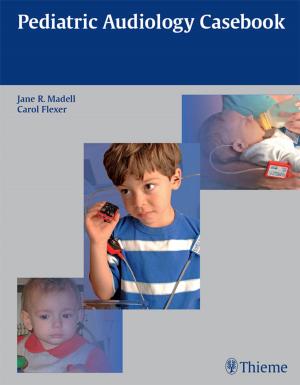 Cover of the book Pediatric Audiology Casebook by Olav Jansen, Hartmut Brueckmann