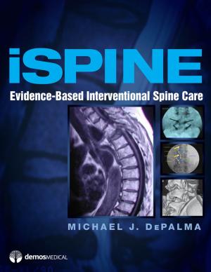 Cover of the book iSpine by Dr. Hubert Fernandez, MD, Dr. Paul Tuite, MD, Cathi Thomas, RN, MS, Narayan Kissoon, BS, Dr. Laura Ruekert, PharmD, RPh