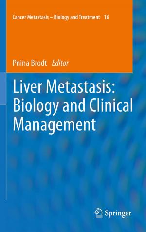 bigCover of the book Liver Metastasis: Biology and Clinical Management by 