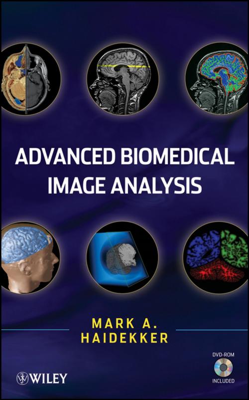 Cover of the book Advanced Biomedical Image Analysis by Mark Haidekker, Wiley