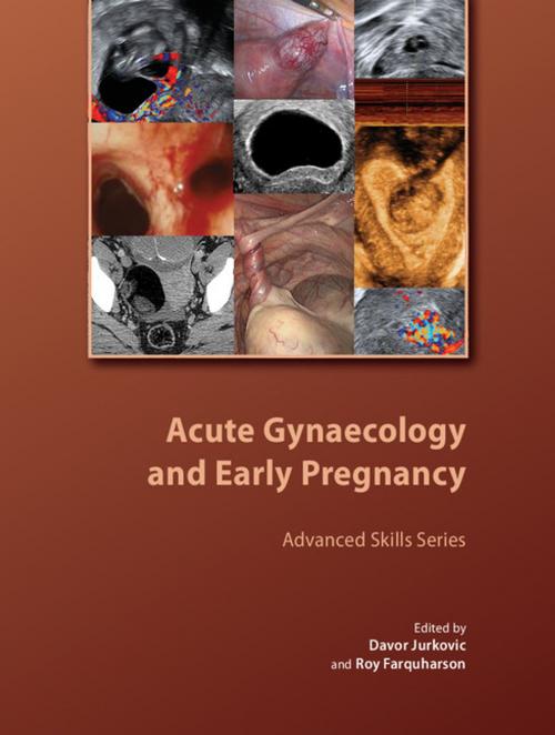Cover of the book Acute Gynaecology and Early Pregnancy by , Royal College of Obstetricians and Gynaecologists (RCOG)