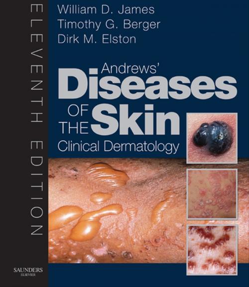 Cover of the book Andrew's Diseases of the Skin E-Book by William D. James, MD, Dirk Elston, MD, Timothy Berger, MD, Elsevier Health Sciences