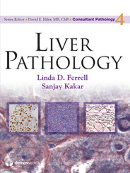 Cover of the book Liver Pathology by David Elder, MB, ChB, Springer Publishing Company