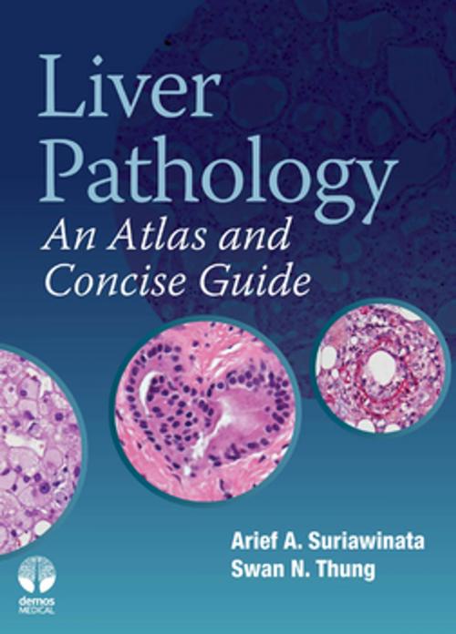 Cover of the book Liver Pathology by Arief A Suriawinata, MD, Swan N. Thung, MD, Springer Publishing Company