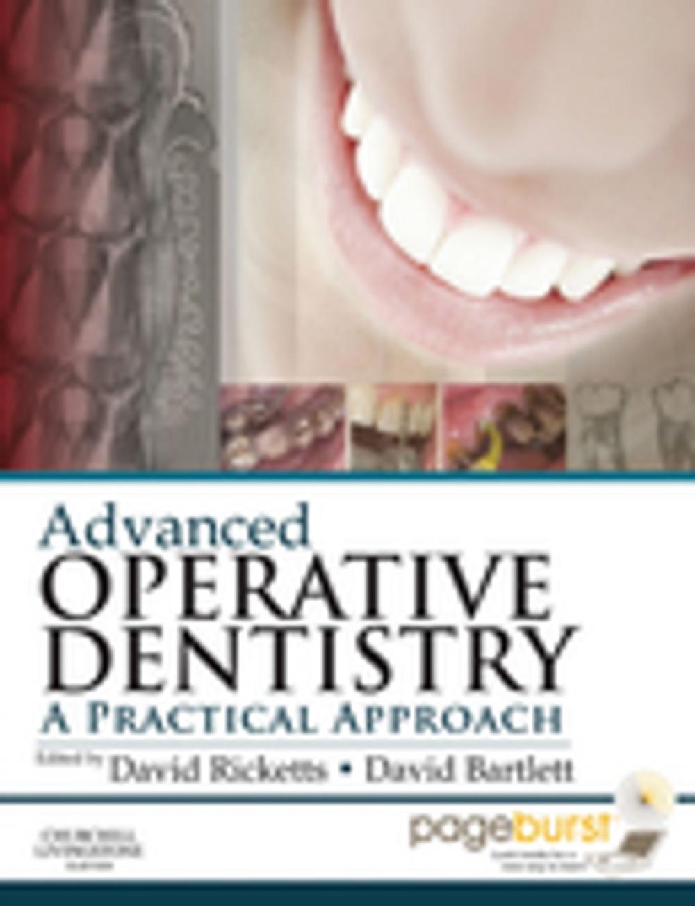 Big bigCover of Advanced Operative Dentistry E-Book