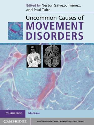 Cover of the book Uncommon Causes of Movement Disorders by Dr. Joel Berman
