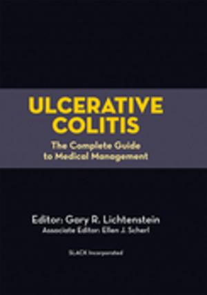 Cover of the book Ulcerative Colitis by Robert Lowe, Francis Farraye