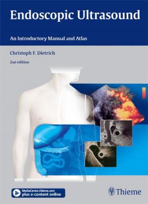 Book cover of Endoscopic Ultrasound