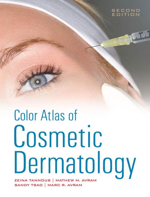 Cover of the book Color Atlas of Cosmetic Dermatology, Second Edition by Zeina Tannous, Mathew Avram, Marc Avram, Sandy Tsao, McGraw-Hill Education