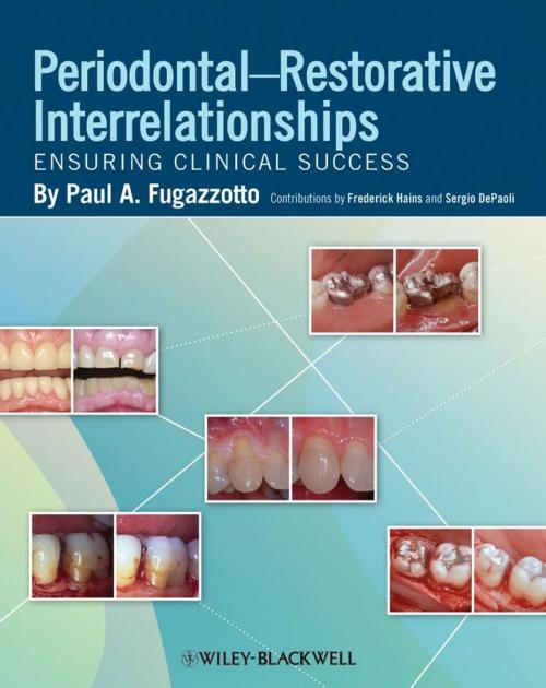 Cover of the book Periodontal-Restorative Interrelationships by Paul A. Fugazzotto, Frederick Hains, Sergio DePaoli, Wiley