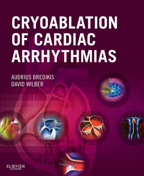 Cover of the book Cryoablation of Cardiac Arrhythmias E-Book by Audrius Bredikis, MD, David Wilber, MD, Elsevier Health Sciences