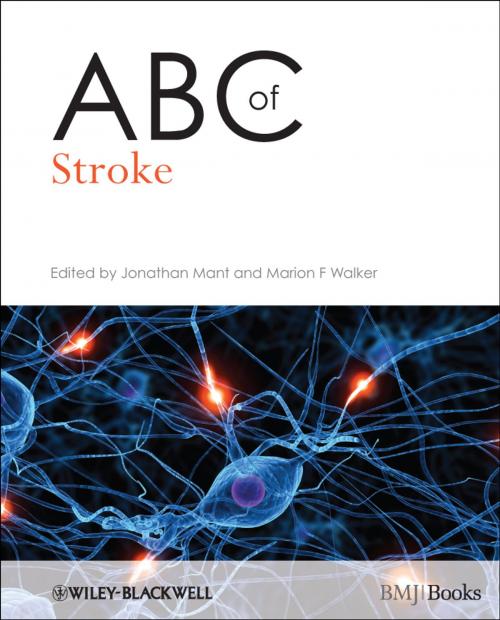 Cover of the book ABC of Stroke by , Wiley