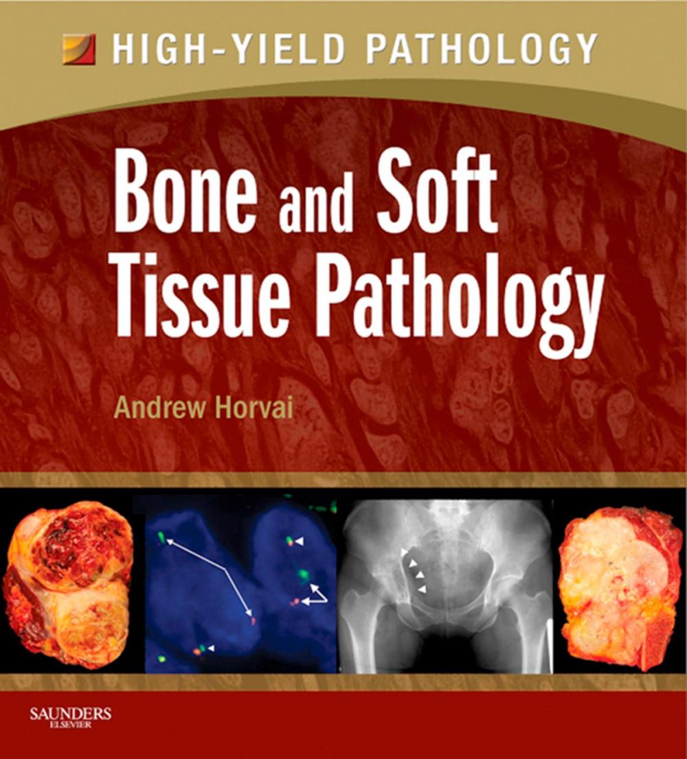Big bigCover of Bone and Soft Tissue Pathology E-Book