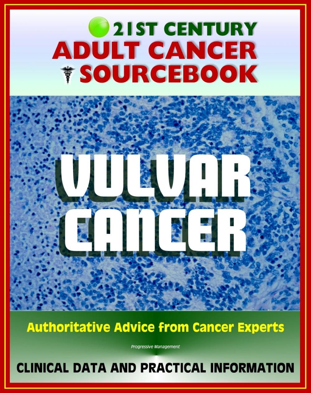 Big bigCover of 21st Century Adult Cancer Sourcebook: Vulvar Cancer - Clinical Data for Patients, Families, and Physicians